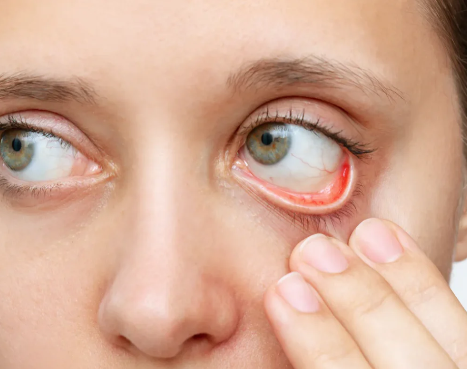 Anatomy, Physiology and Pathology of Conjunctiva