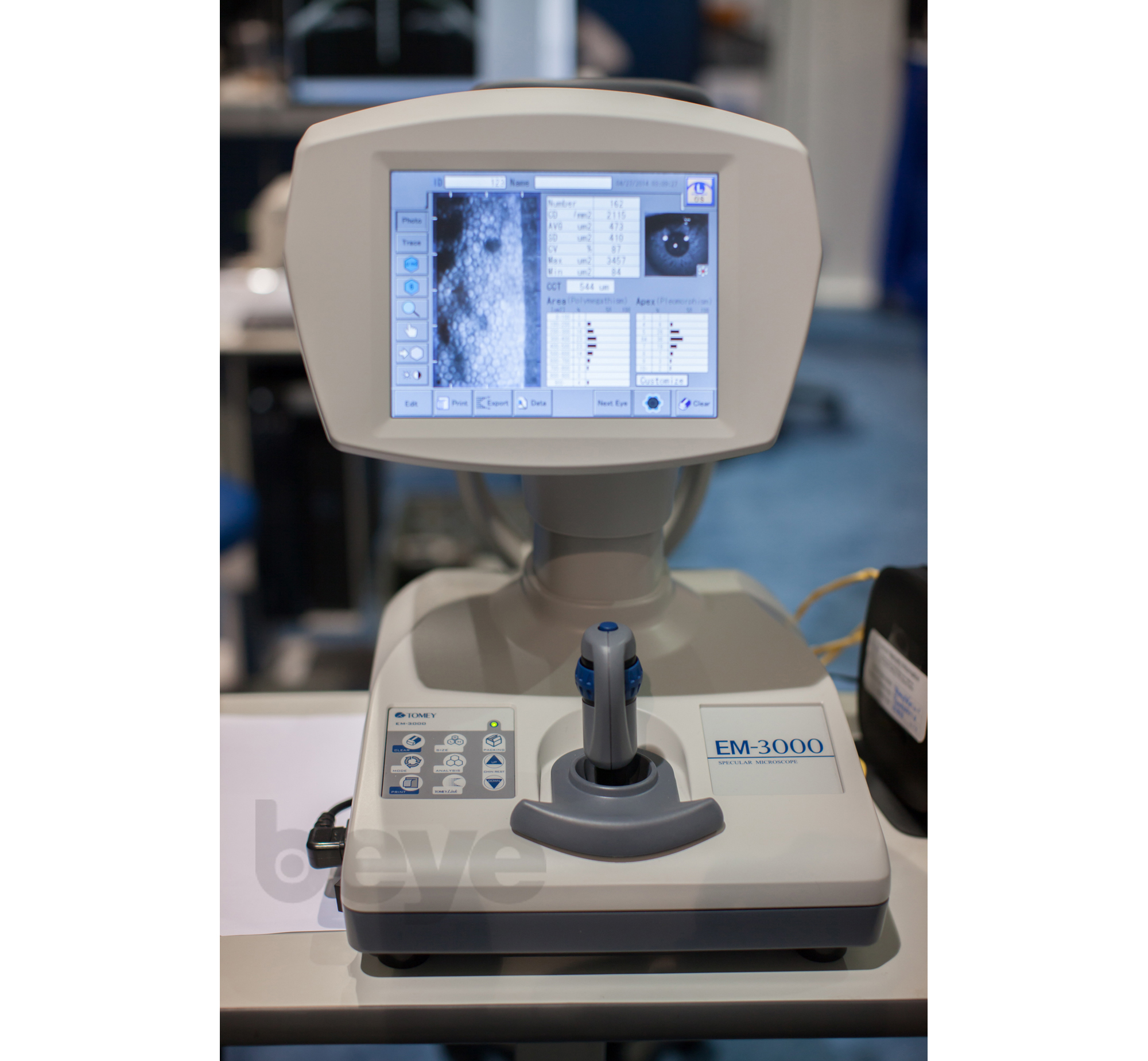 Specular Microscopy