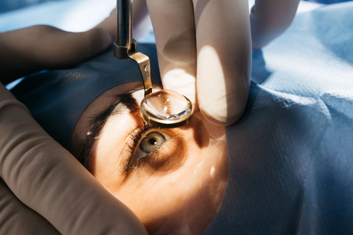 Refractive Surgery and its Types